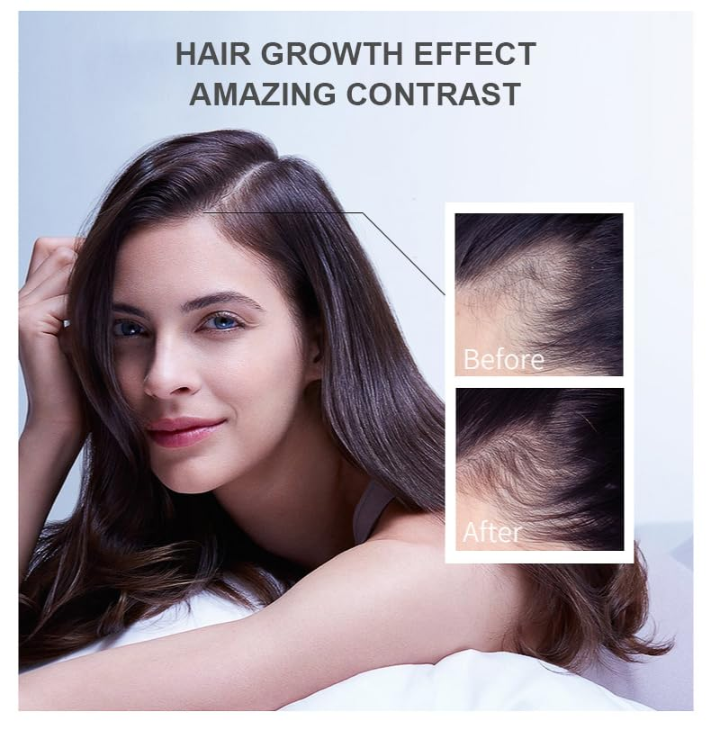 Hair Growth Oil Ginger Biotin  - Hair Care Fragrance Essential Oil 评论和价格