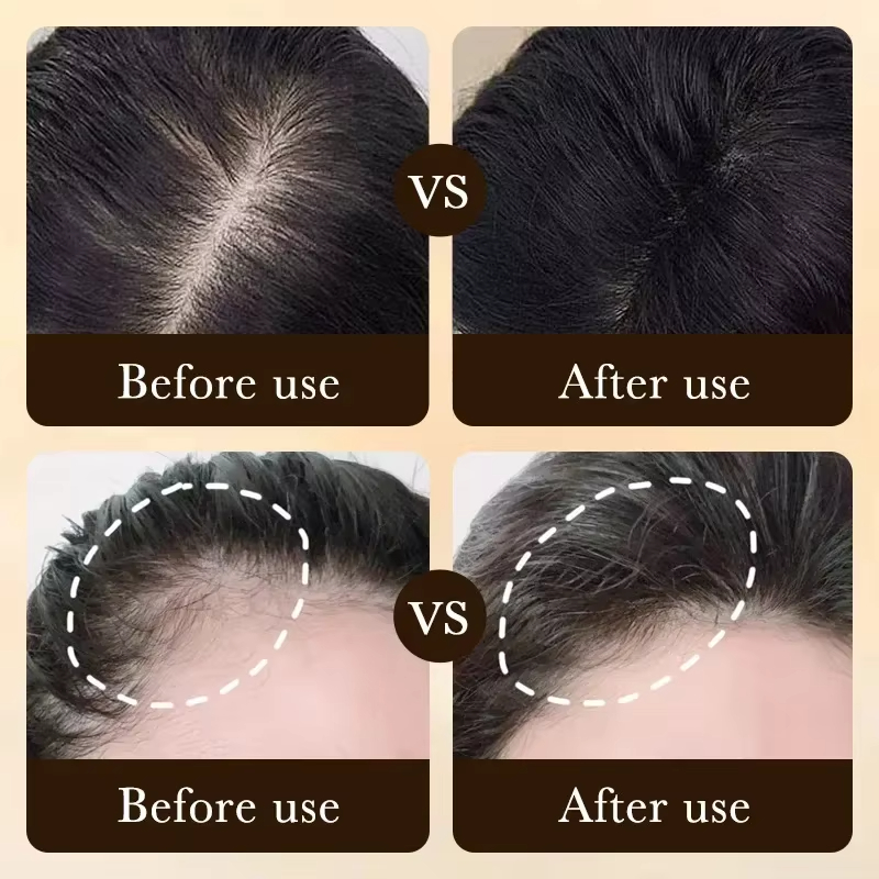 One-stop hair care: Solve basi - Hair Care Basic 评论和价格