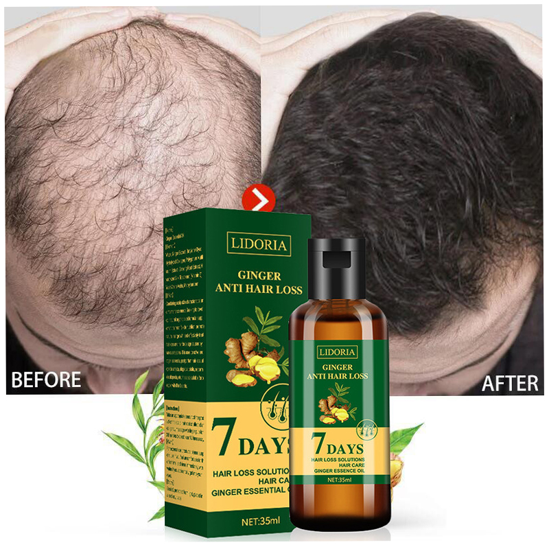 Ginger Hair Growth Essential O - Hair Care Fragrance Essential Oil 评论和价格