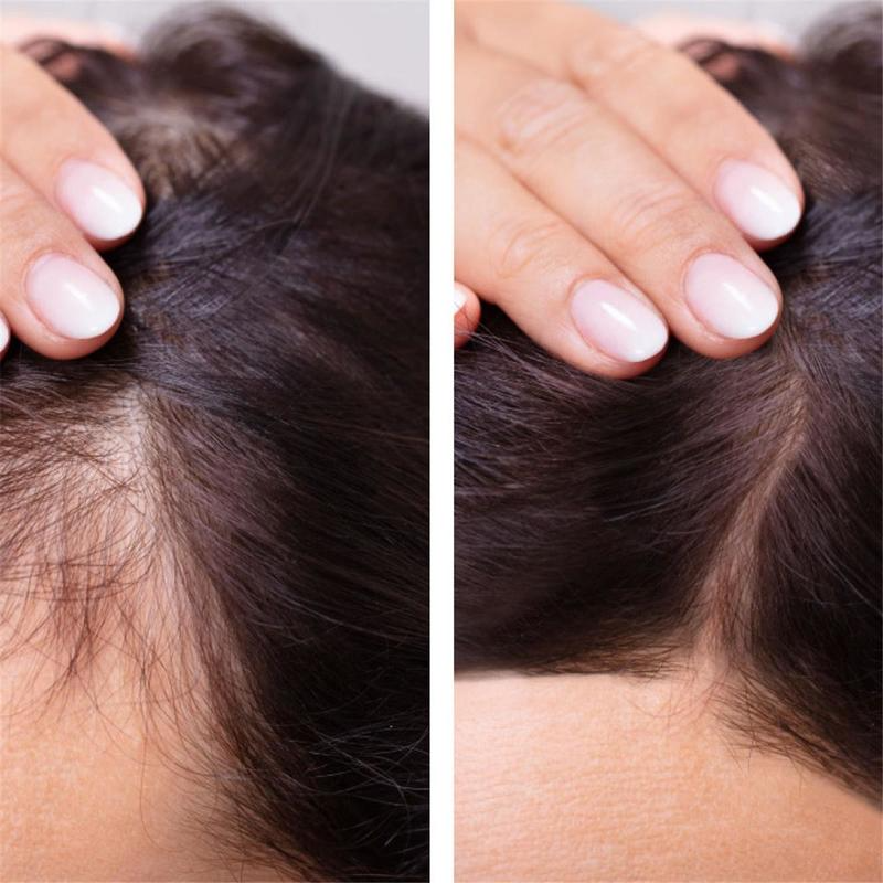 Ginger Hair Growth Essential O - Hair Care Fragrance Essential Oil 评论和价格