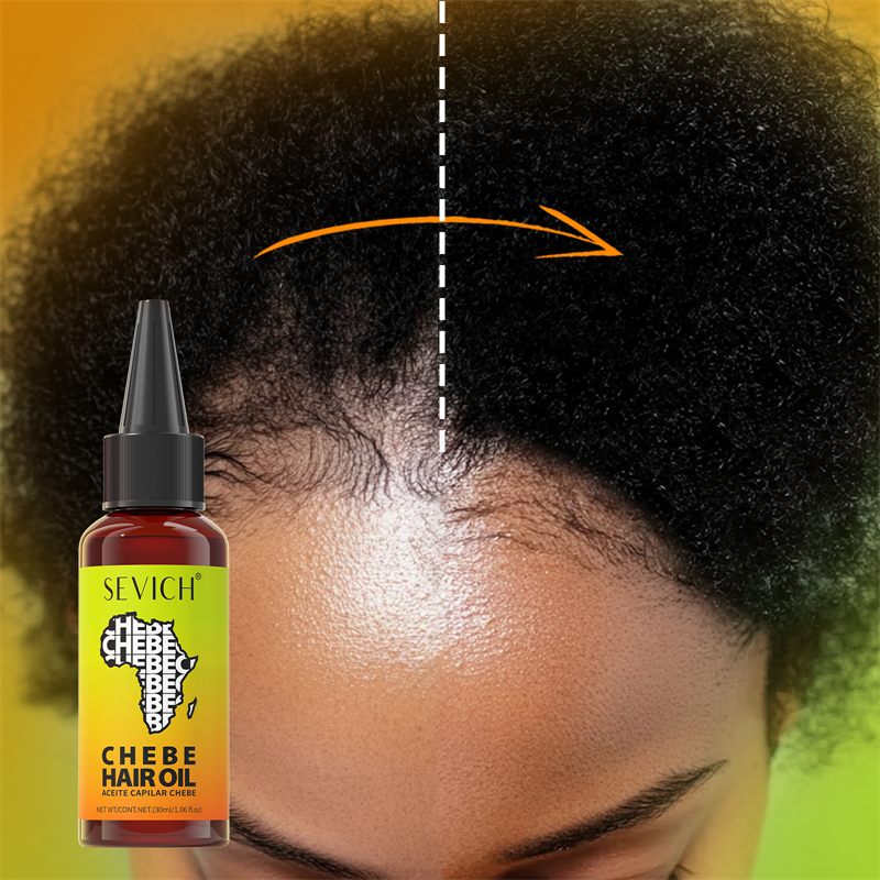 Chebe Fast Hair Growth Oil Afr - Hair Care Fragrance Essential Oil 评论和价格