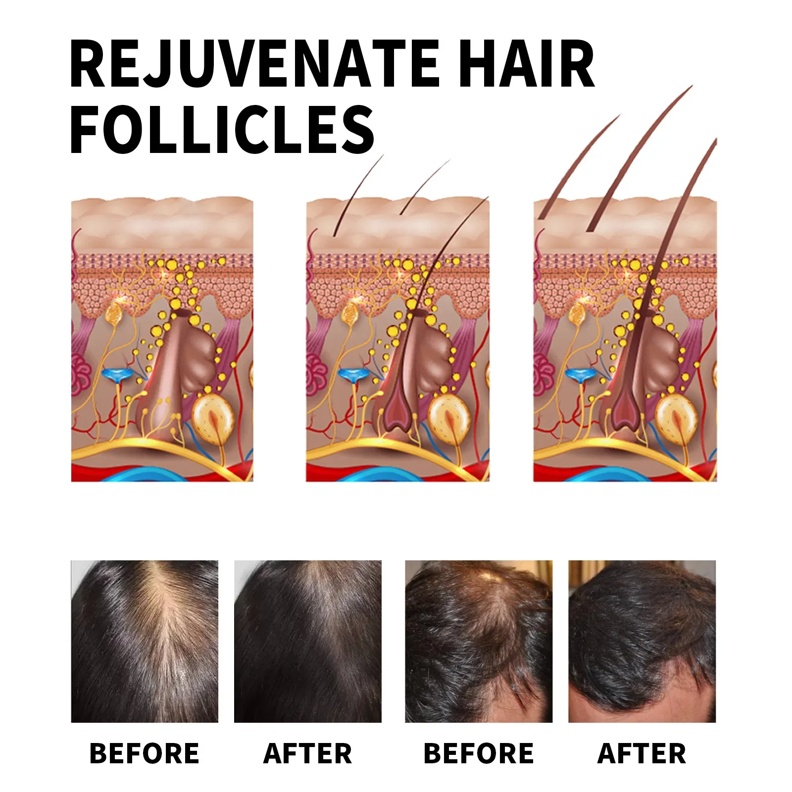 Ginger Hair Growth Products Fa - Hair Care Fragrance Essential Oil 评论和价格
