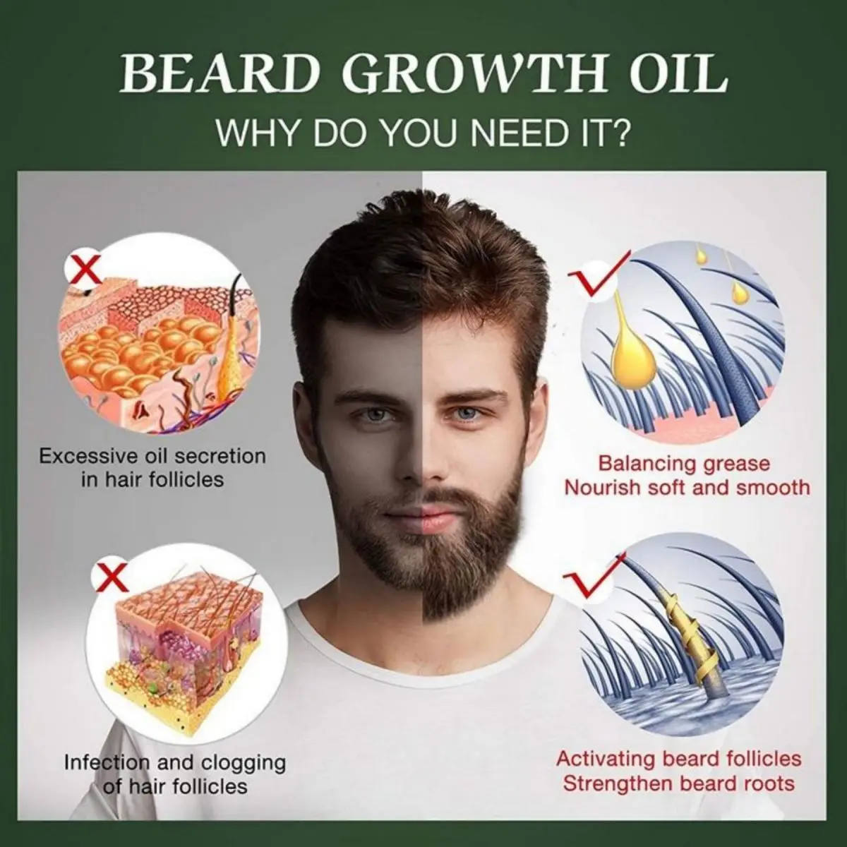 Fast Beard Growth Oil Beard Oi - Hair Care Fragrance Essential Oil 评论和价格